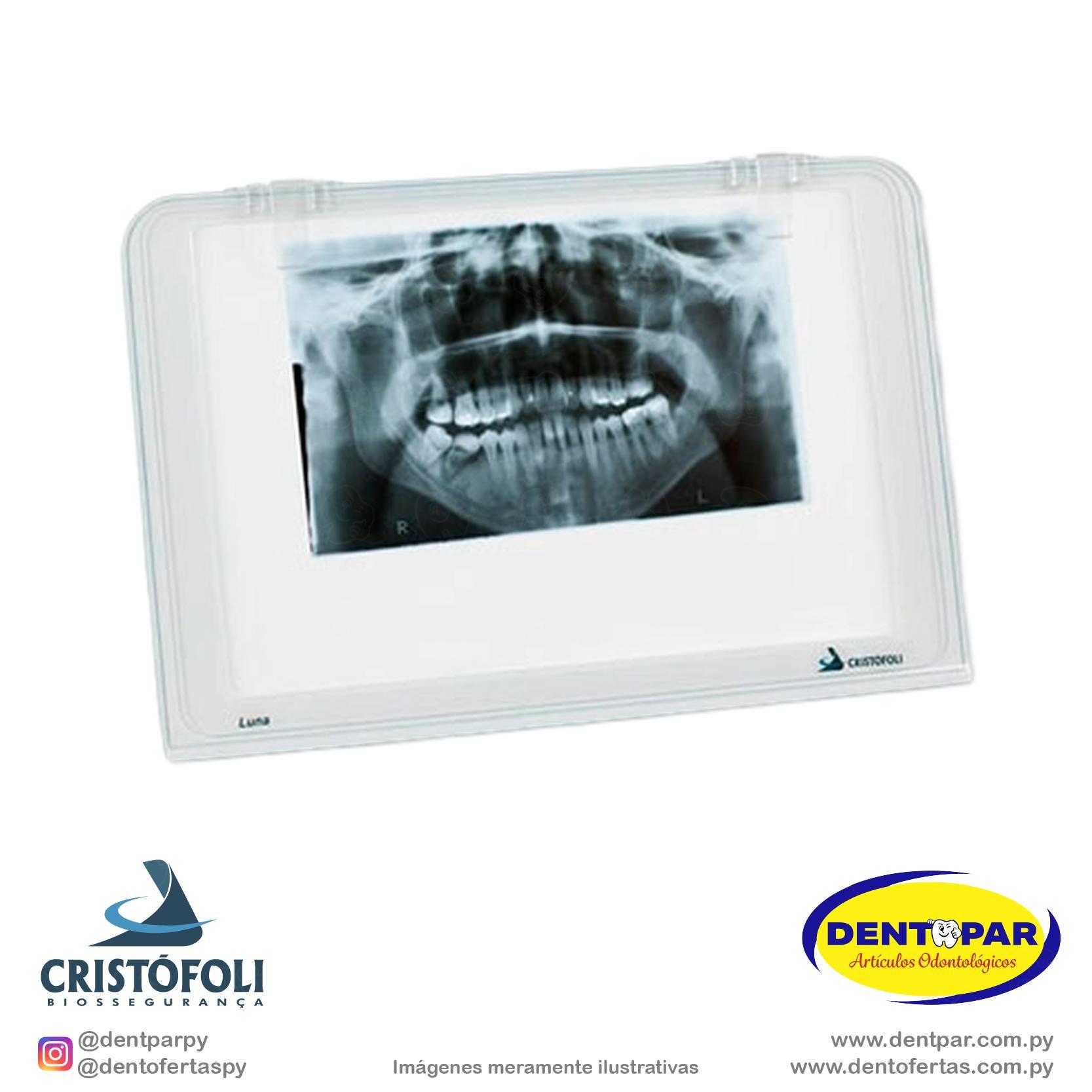 Imagen del producto Negatoscopio LUNA 24*36*3cm
