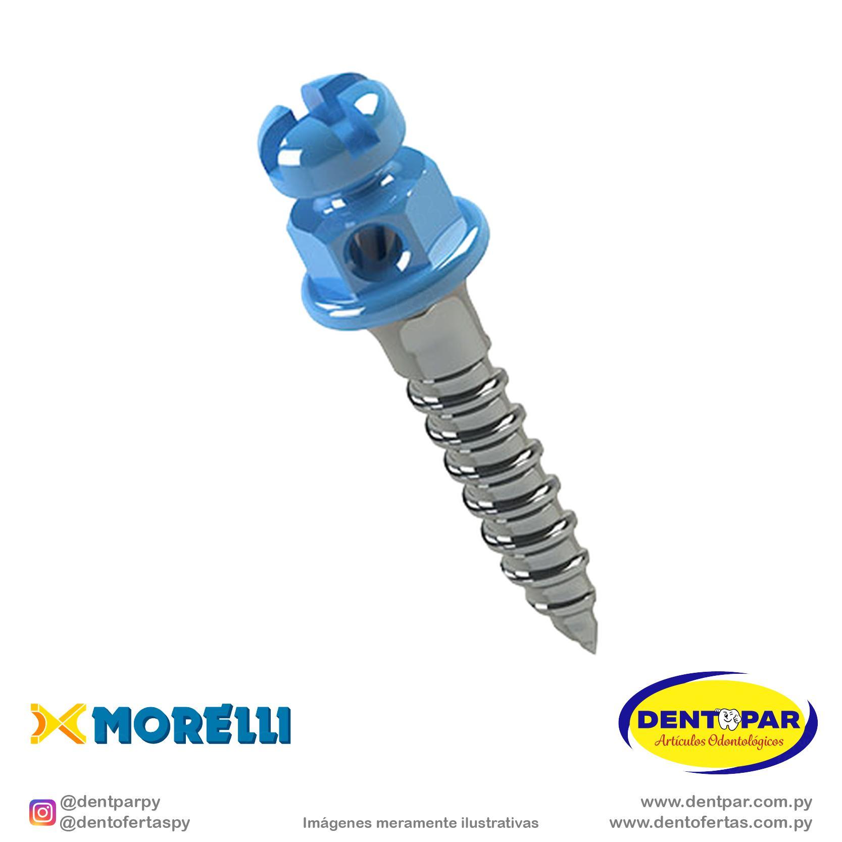 Imagen del producto Implante P/ Anclaje Ort.C/1 6mm*1mm AN.H