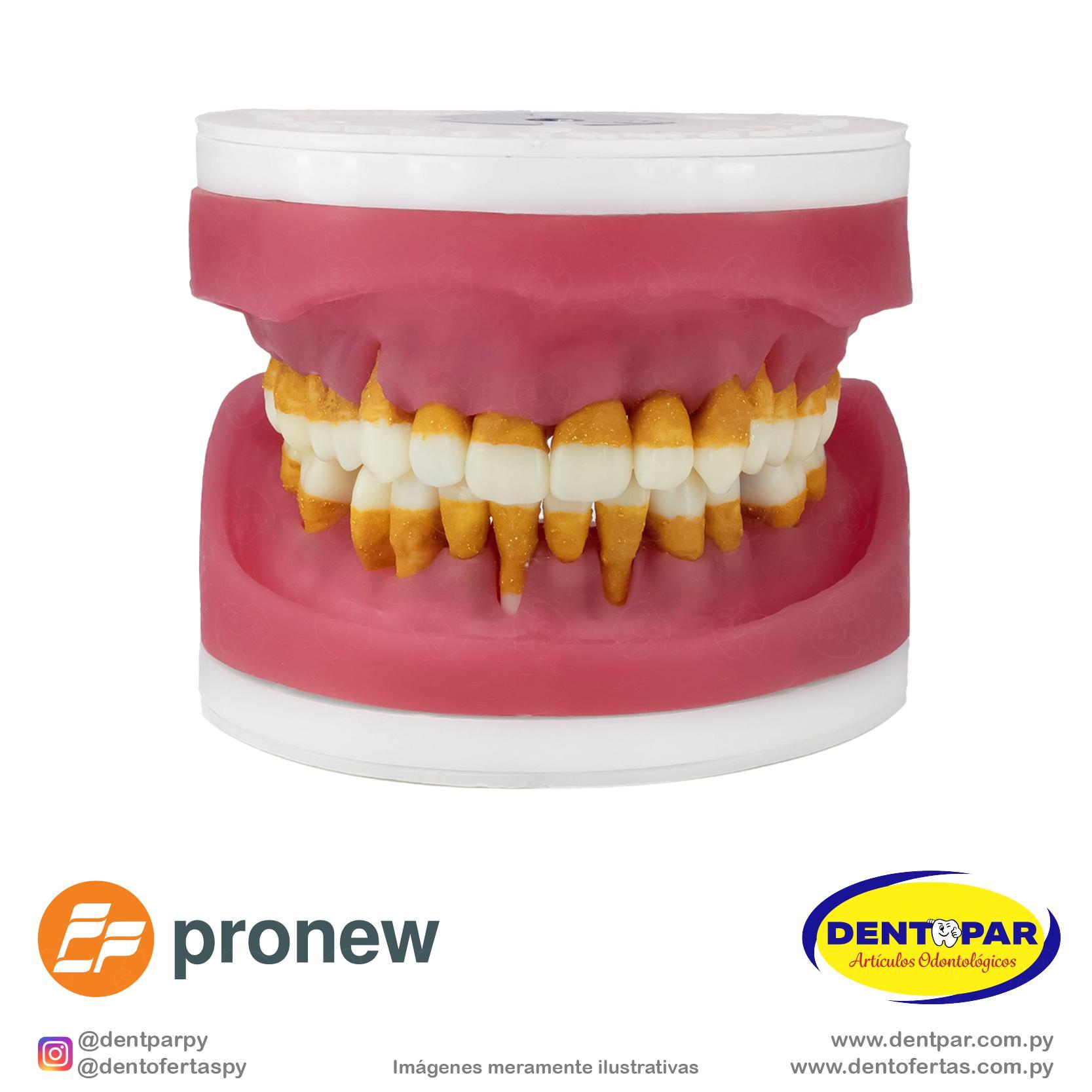 Imagen del producto Repuesto de Cirugía con Dientes de Perio