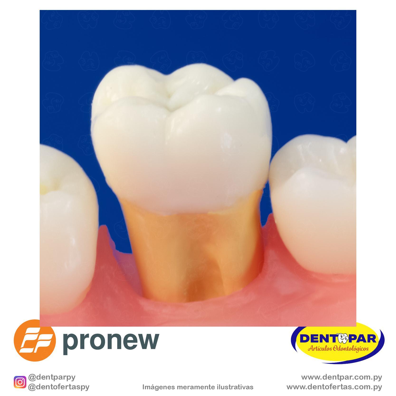 Imagen del producto Diente Endo Radiopaco con Caries Oculta