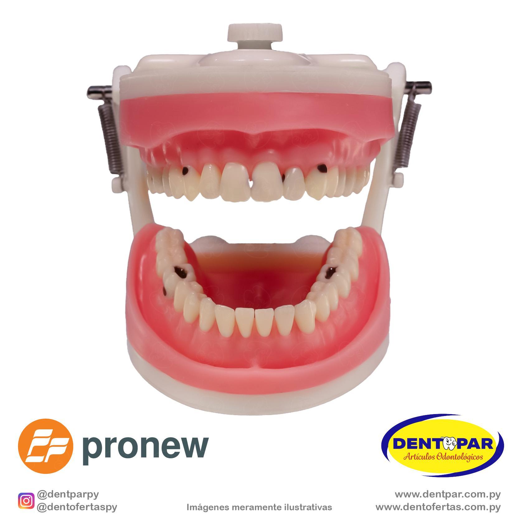 Imagen del producto Juego de Dientes Cariados