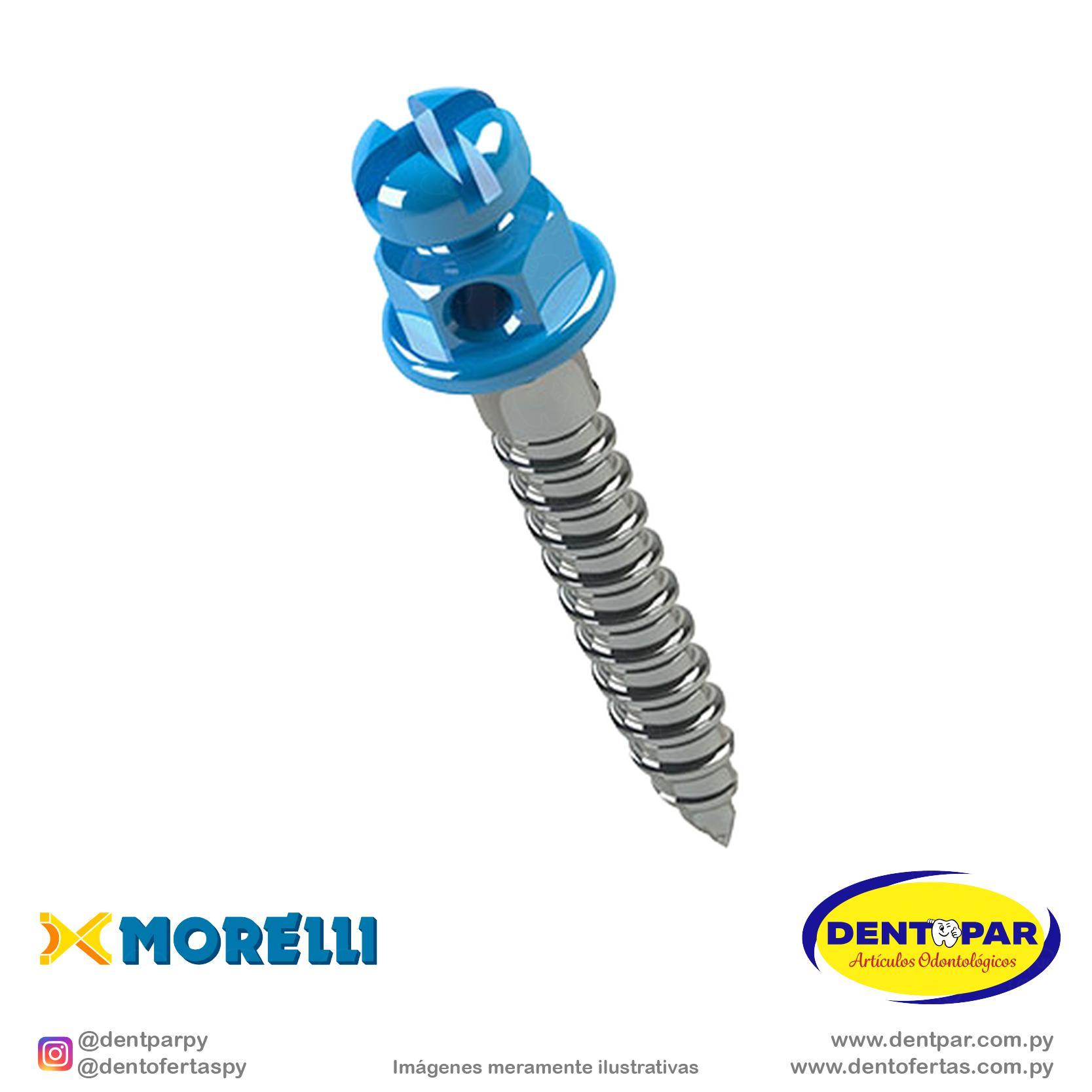 Imagen del producto Implante P/ Anclaje Ort.C/1 8mm*1mm AN.H