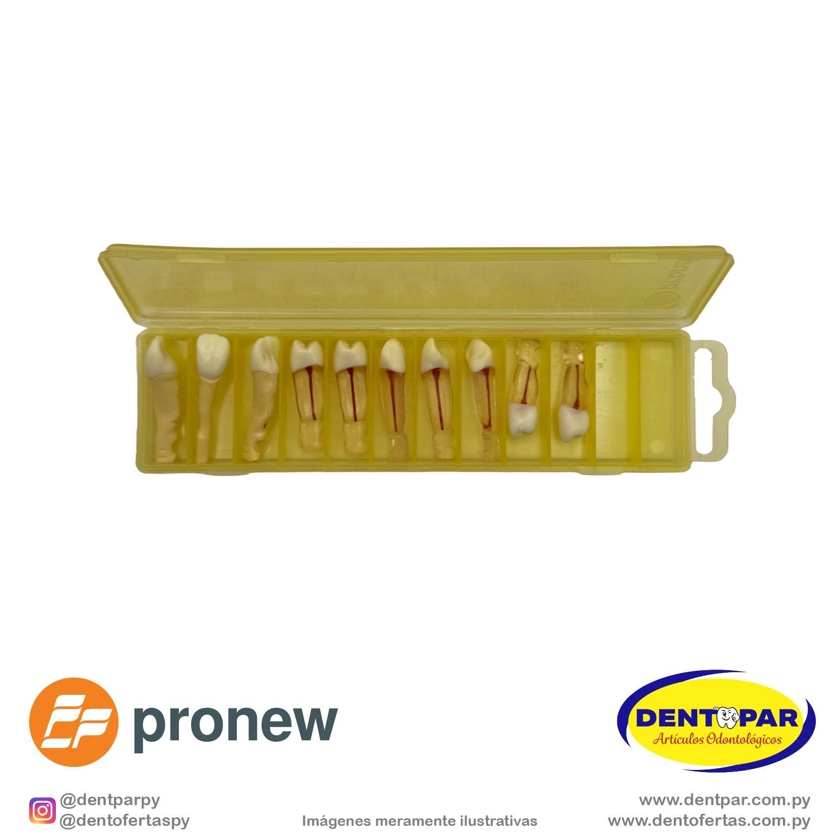 Imagen del producto Juego Dientes de Endodoncia